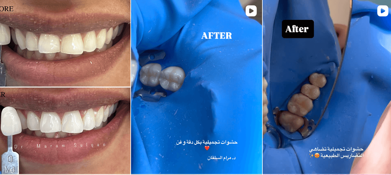 محتوى 2