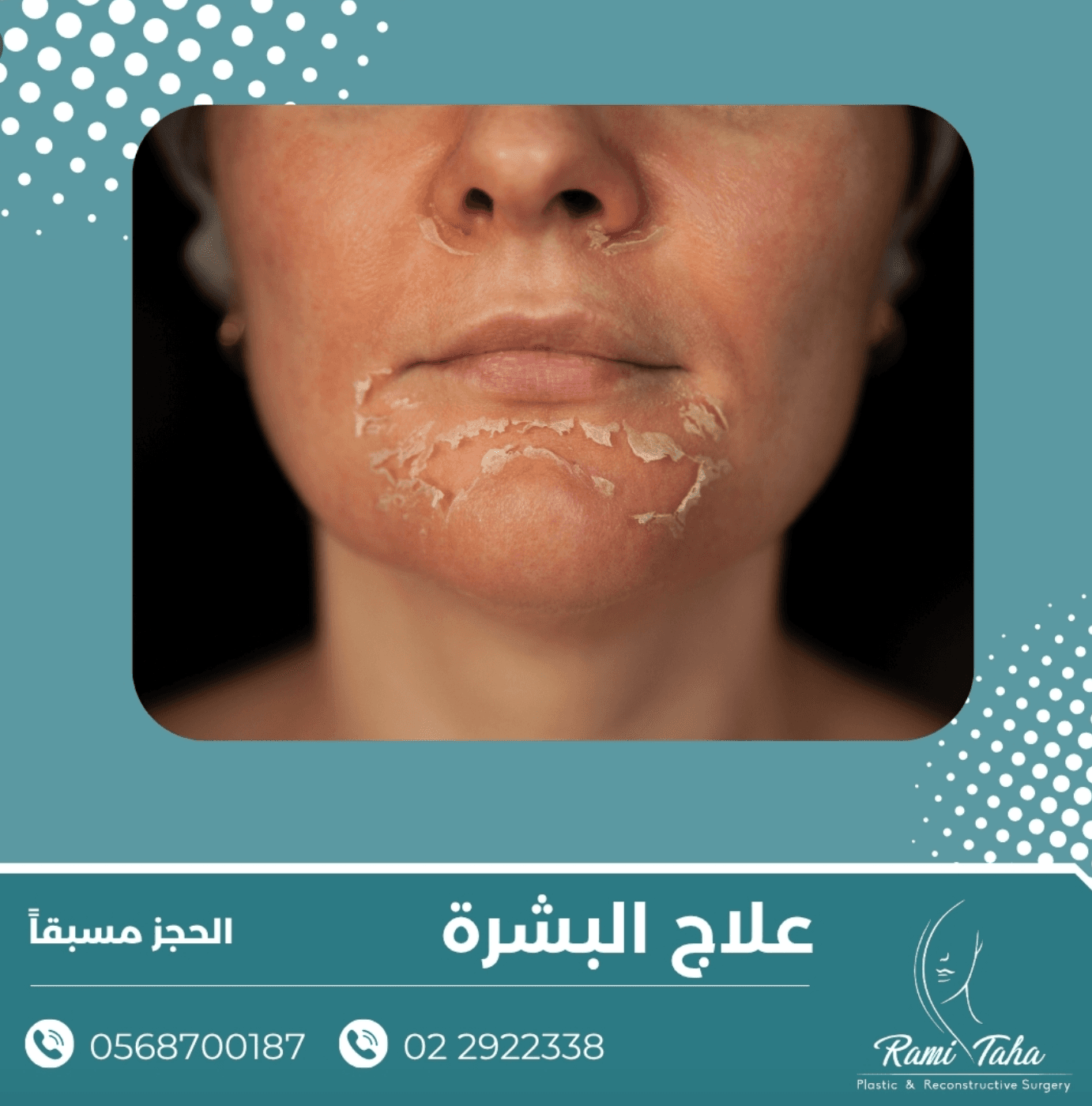 محتوى 5